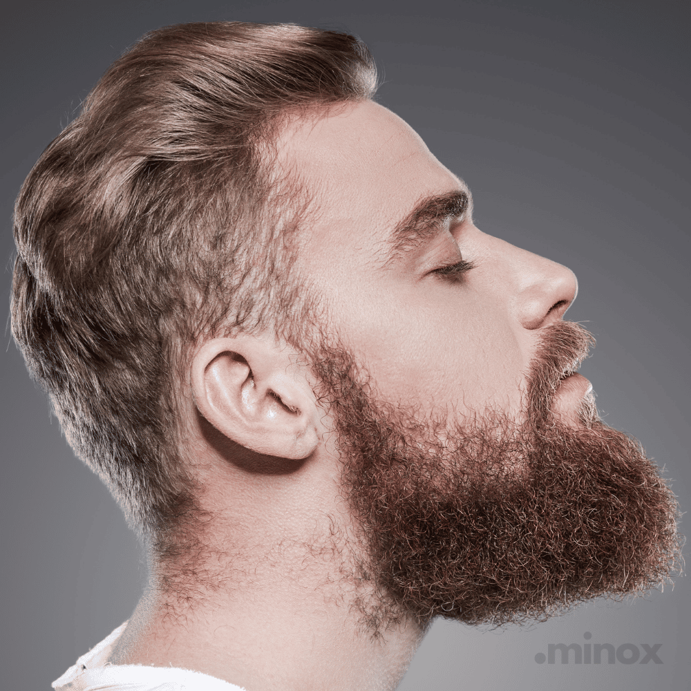 .minox Minoxidil | 3 Meses