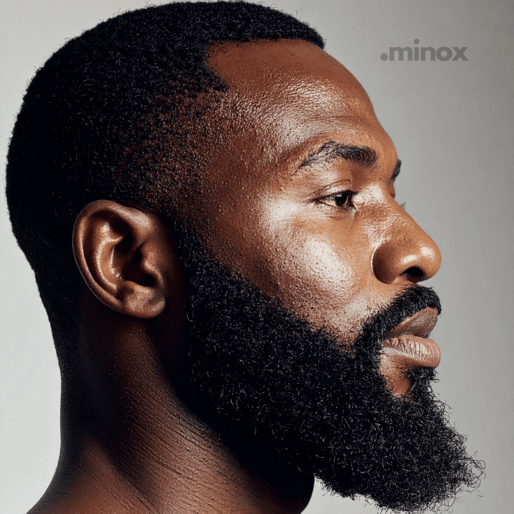 .minox Minoxidil | 3 Meses
